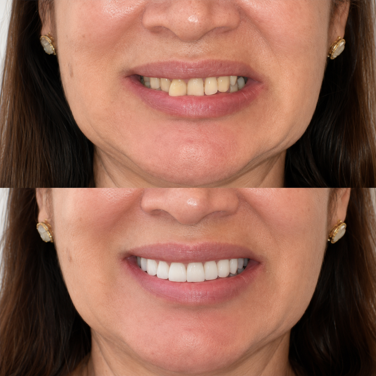 Estética do Sorriso — Dra. Olivia Brandão