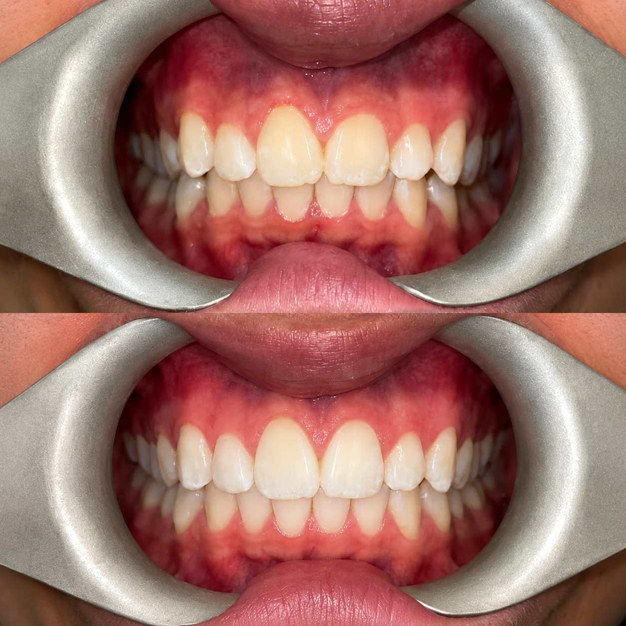 Resultado de Periodontia — Dra. Olivia Brandão